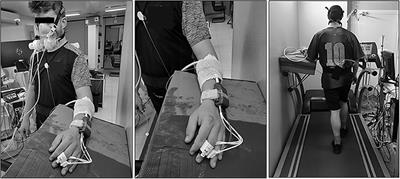 Cardiorespiratory Coordination During Exercise in Adults With Down Syndrome